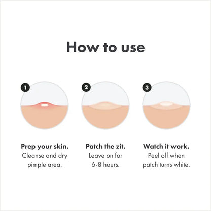 Acne Patch Day Night Repair