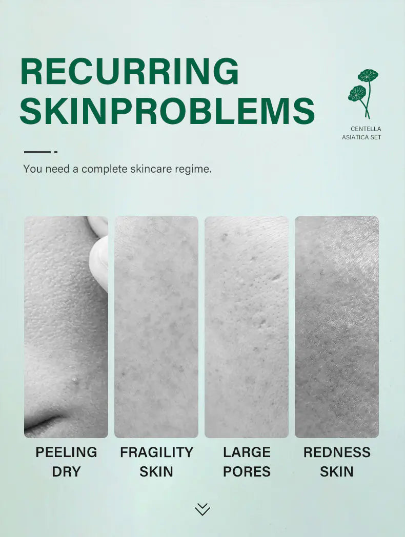 Private Label Skin Repair Centella Skin Care Kit Soothes Acne Face Care Centella Asiatica Extract Natural Facial Skin Care Set
